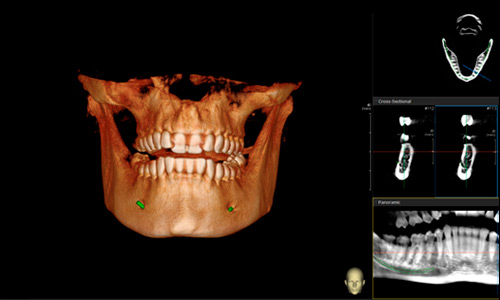 Limpieza Bucal, estetica dental, ortodoncia, endodoncia
