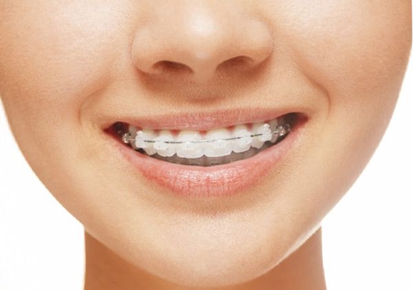 dentista asturias, clinica dental point aviles, endodoncia, ortodoncia
