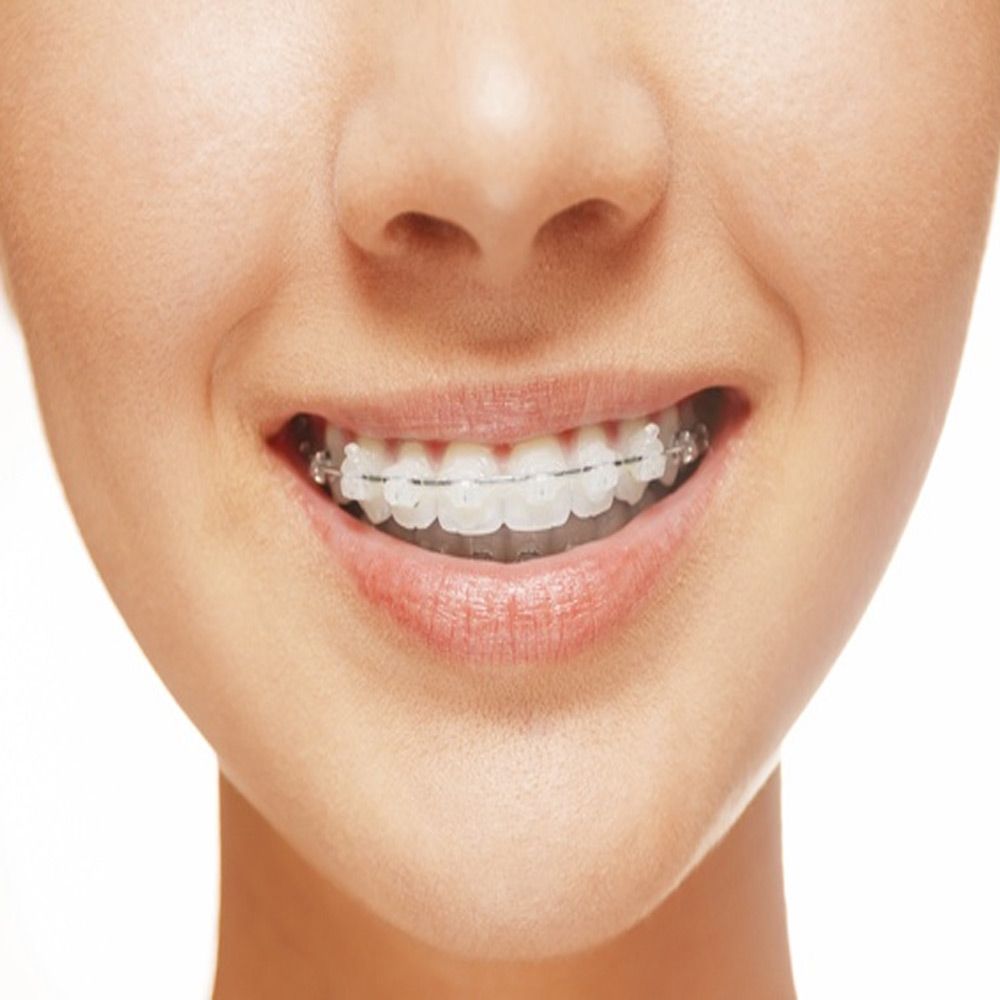 Ortodoncia, endodoncia, estetica dental, ortodoncia, dentista asturias