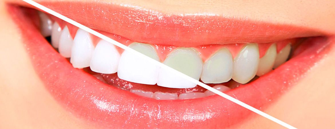dentista asturias, aviles, endodoncia, ortodoncia, estetica dental